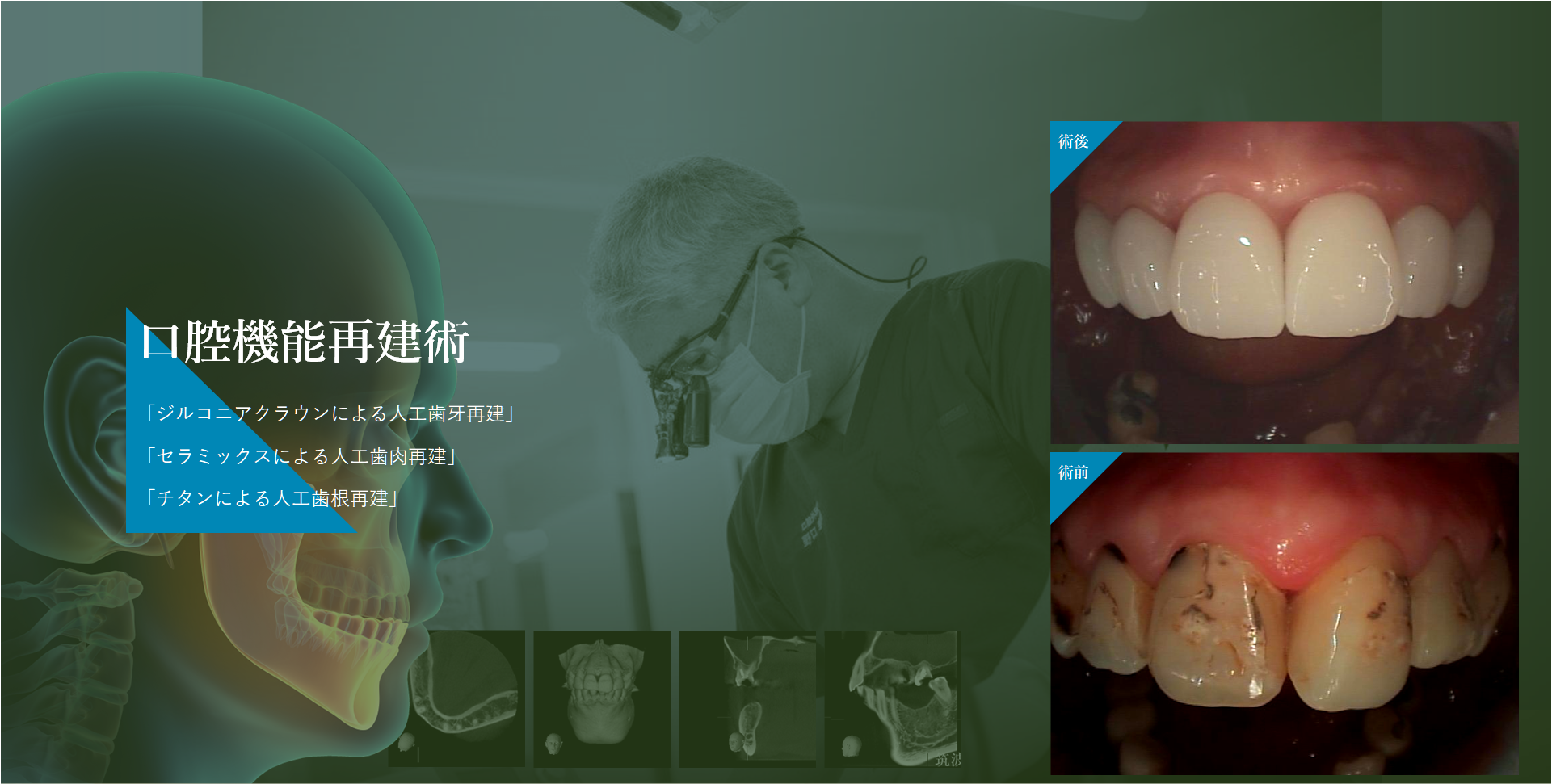 平成25年度関東地方発明表彰においてパーフェクトペリオ®「新規歯周病治療予防薬の発明」で　日本弁理士会会長奨励賞を受賞しました。イメージ